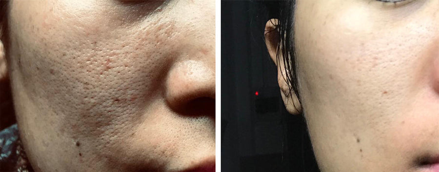 Cosrx BHA Blackhead Power Liquid 100 ml