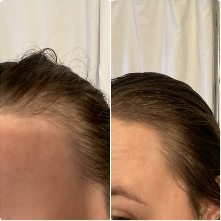 The ordinary سيروم مالتي ببتايد لزيادة كثافة وسمك الشعر 60