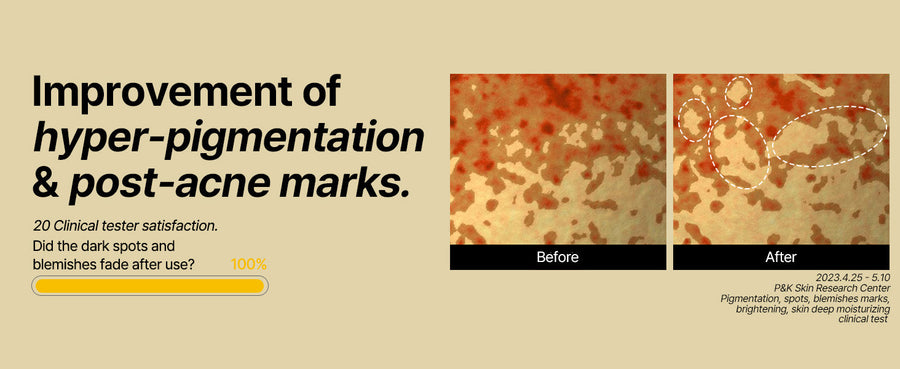 SOME BY MI Yuja Niacin Anti Blemish Cream 60ml